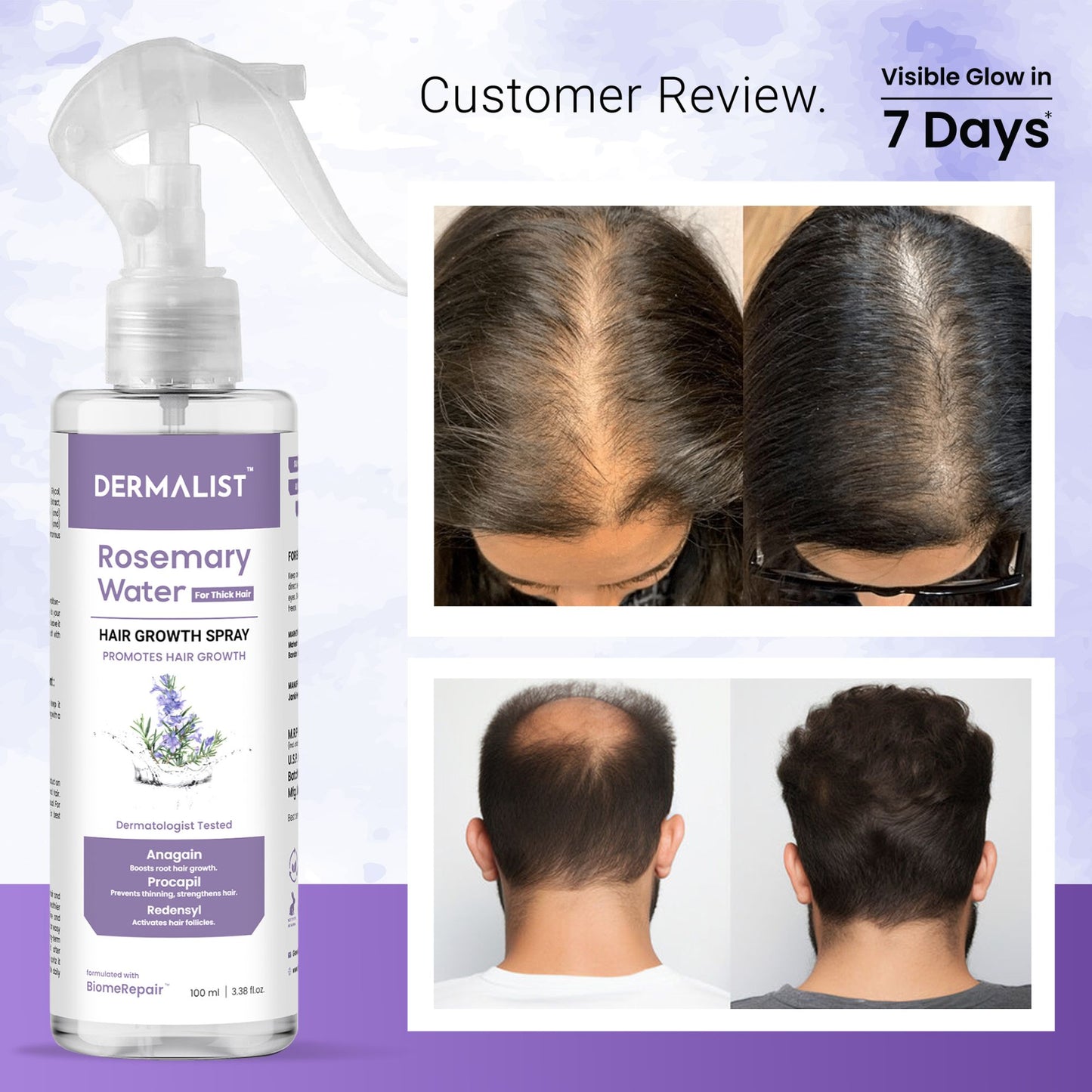 Dermalist Rosemary Water For Hair Growth | Hair Spray for Regrowth | Rosemary Hair Mist Hair Mist (100 ml)