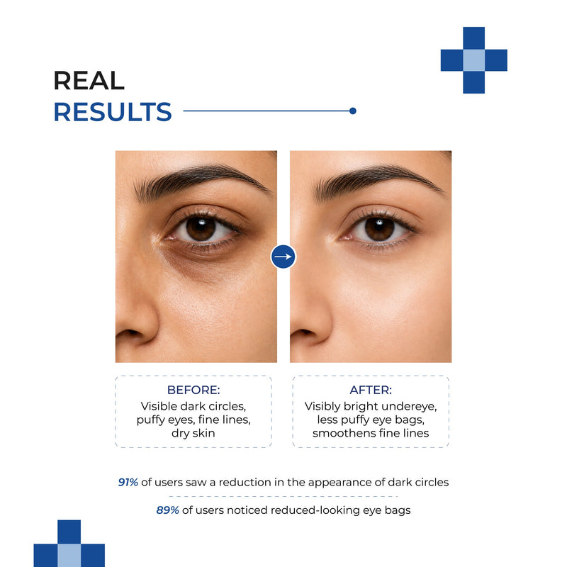 Dermalist Multi-Effect Moisturizing Under Eye Cream | With Retinal, Vitamin K & Caffeine | Reduces Dark Circles, Puffiness, Fine Lines & Wrinkles | For Men & Women | 15 gm