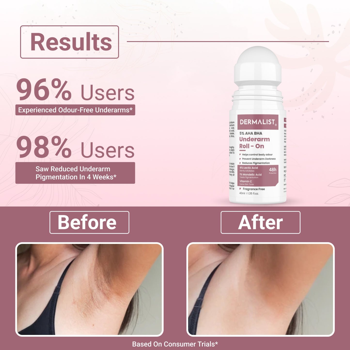 Dermalist 5% AHA BHA Underarm Roll On | Reduces Pigmentation & Odour | Fragrance Free Deodorant Roll-on - For Men & Women (40 ml)