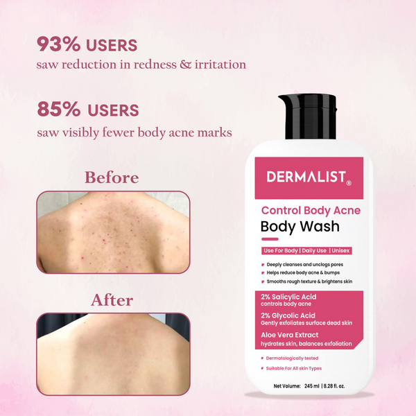 Dermalist 2% Salicylic Acid Acne Body Wash Shower Gel for Acne Control For Women & Men(2 x 245 ml)