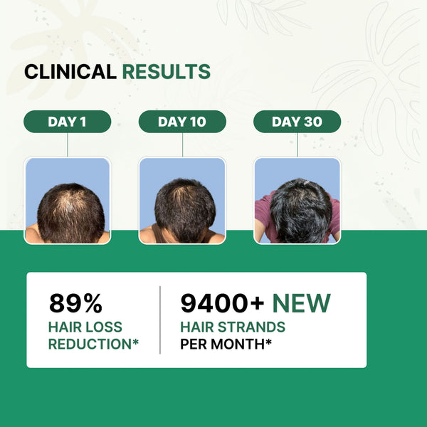 Dermalist Rosemary Advanced Hair Growth Serum with 3% Redensyl, 4% AnaGain, 3% Baicapil |(50 ml)