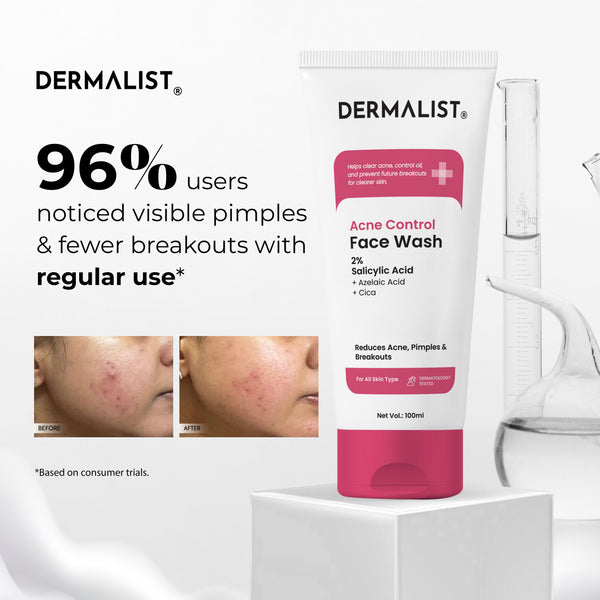 Dermalist Acne Control Face Wash 2% Salicylic Acid for Oily & Acne-Prone Skin | Controls Oil, Prevents Acne & Fades Acne Marks | With Niacinamide | Soap-Free, Sulphate-Free Cleanser | For Men & Women 300 Ml (Pack Of 3 Pcs)