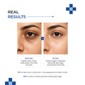 Dermalist Multi-Effect Moisturizing Under Eye Cream | With Retinal, Vitamin K & Caffeine | Reduces Dark Circles, Puffiness, Fine Lines & Wrinkles | For Men & Women | 15 gm