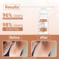 Dermalist 5% AHA BHA Peach Fragrance Underarm Roll For Men & Women 40 ml