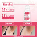 Dermalist 5% AHA BHA Watermelon Fragrance Underarm Roll On For Men & Women 40 ml