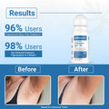 Dermalist 5% AHA BHA Underarm Roll On | Reduces Pigmentation & Odour | Aqua Fragrance Deodorant Roll-on - For Men & Women  (40 ml)