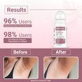 Dermalist 5% AHA BHA fragrance Free Underarm Roll On For Men & Women 40 ml