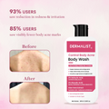 Dermalist 2% Salicylic Acid Acne Body Wash Shower Gel for Acne Control For Women & Men  (245 ml)